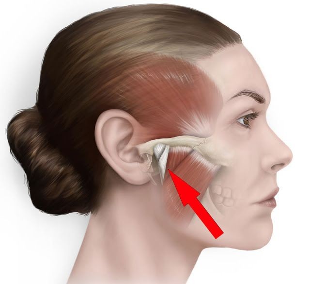 Close-up of a female face illustrating facial muscles, highlighting areas targeted during a buccal massage