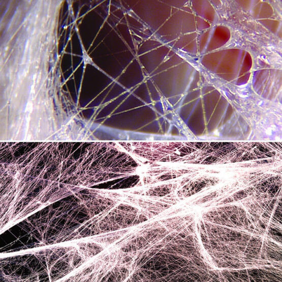 Close-up view of fascia tissue, showcasing its intricate fibrous network and texture.